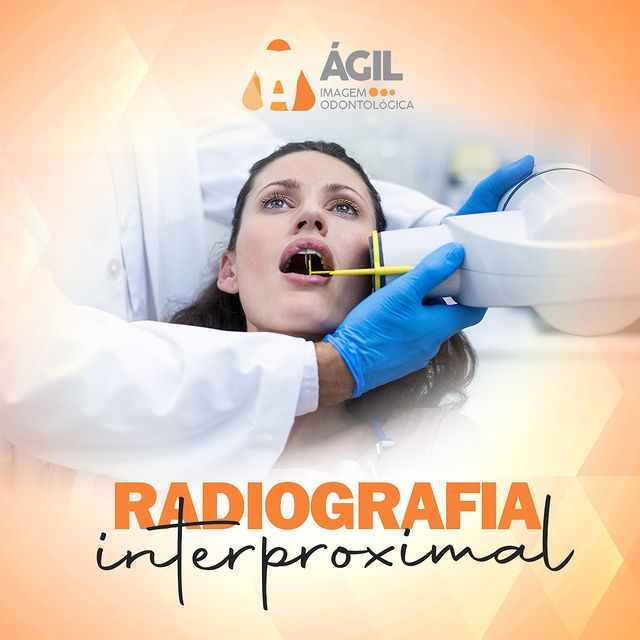 Radiografia Interproximal